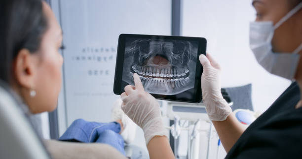 Licensed Teeth Whitening service in Glendive, MT - Smile Center Dentistry